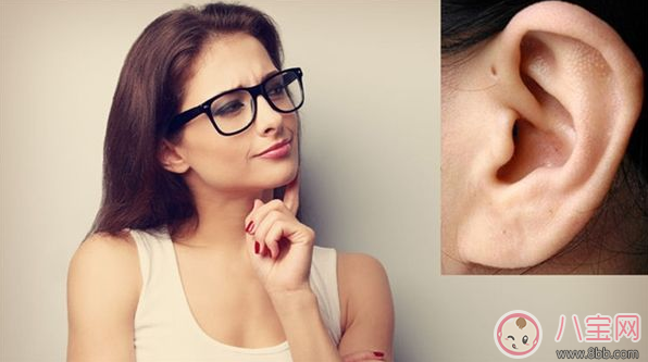 孩子耳朵上面有小孔是什么 耳朵的小孔是富貴孔嗎