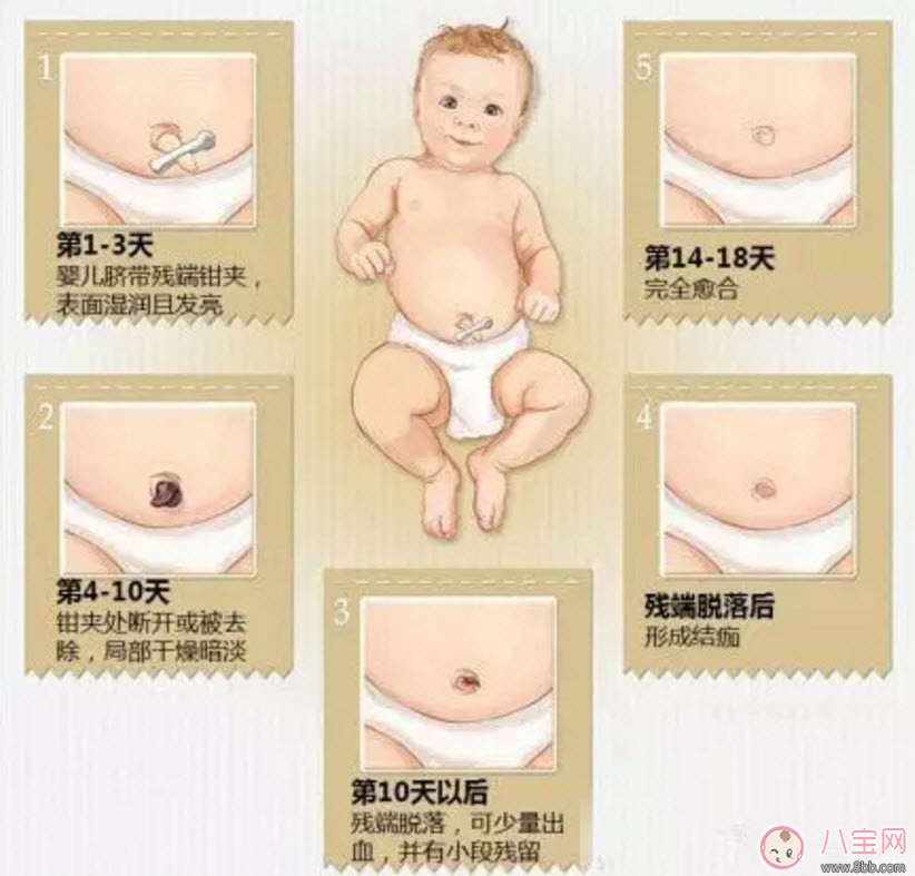 新生兒臍帶脫落的時間是幾天 新生兒臍帶脫落的過程圖解