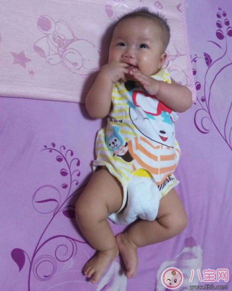 孩子總是長不胖是不是營養(yǎng)不良 寶寶怎么吃都瘦怎么辦