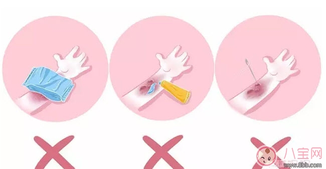 寶寶燙傷怎么辦 寶寶燙傷急救處理方法