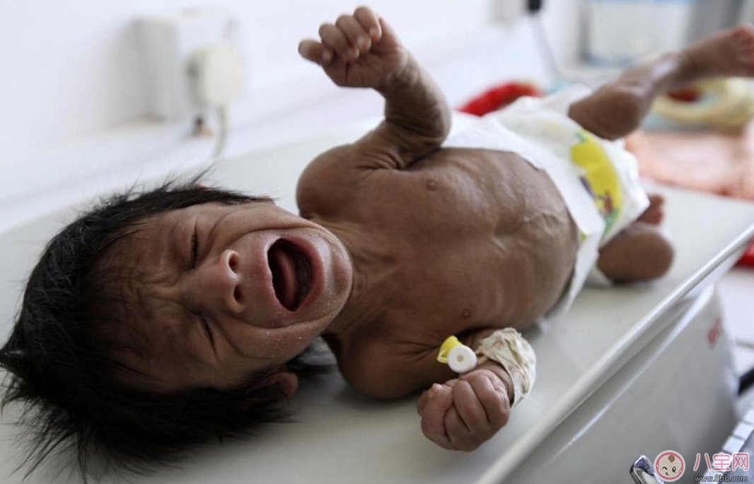 孩子這種情況居然是營養(yǎng)不良的暗示 快給孩子調整過來