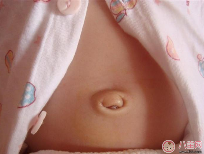 寶寶肚臍護(hù)理有方法 三不要方法要記牢 寶寶肚臍護(hù)理有方法 三不要方法要記牢