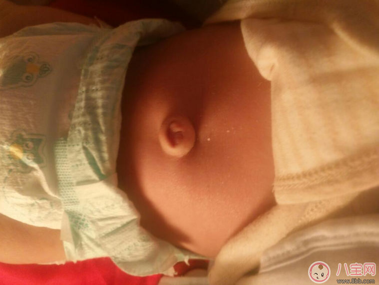 寶寶肚臍護(hù)理有方法 三不要方法要記牢 寶寶肚臍護(hù)理有方法 三不要方法要記牢