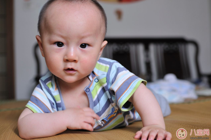 孩子內(nèi)斜視怎么辦 怎么糾正孩子內(nèi)斜視