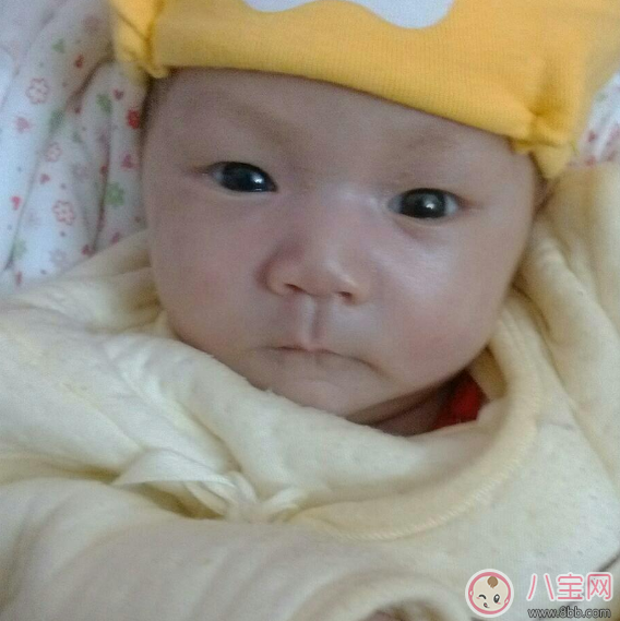 寶寶眼睛有好多眼屎需要馬上就醫(yī) 寶寶哪些情況千萬(wàn)不能耽擱