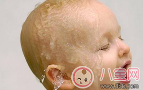 2017三伏天寶寶消化不良引起睡眠性出汗如何調(diào)理 2017三伏天寶寶消化不良引起睡眠性出汗如何調(diào)理