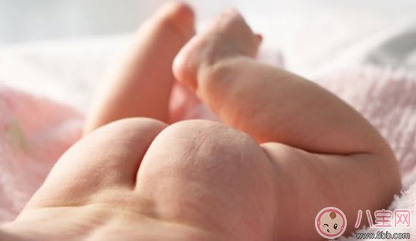 嬰兒長(zhǎng)尿布疹怎么辦 尿布疹是怎么引起的