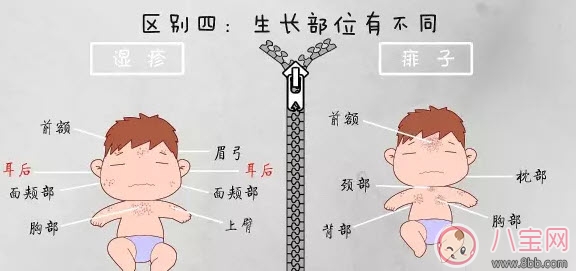 寶寶痱子和濕疹的區(qū)別 濕疹和痱子的區(qū)別圖片