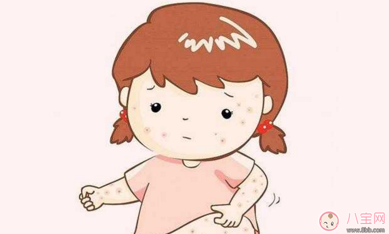 寶寶長痱子怎么辦 給寶寶去痱子的方法有哪些