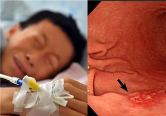 英國5歲癌癥寶寶去世 小孩癌癥的早期信號有哪些