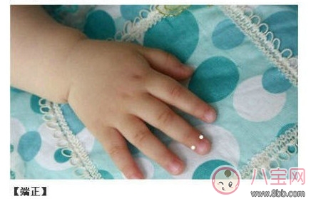 寶寶推拿大全 嬰幼兒常見病的最強克星