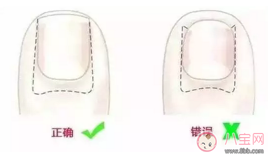 寶寶指甲太長(zhǎng)抓人怎么辦 正確給寶寶剪指甲方法 寶寶指甲太長(zhǎng)抓人怎么辦 正確給寶寶剪指甲方法