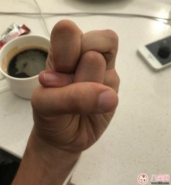 李思思手指炫技新高度  打結指是什么