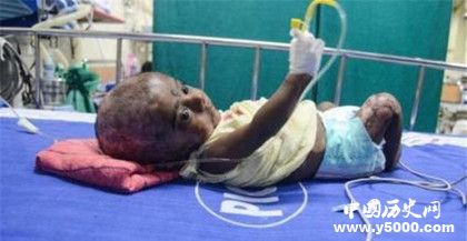 人體自燃是什么現(xiàn)象 人體自燃案列介紹