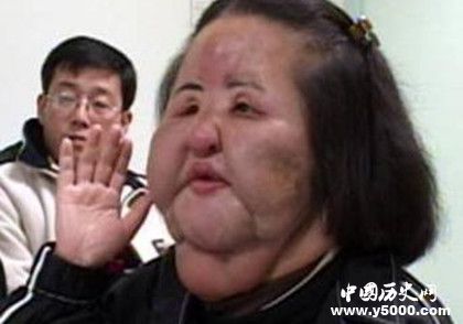 韓國風(fēng)扇女去世韓國風(fēng)扇女簡歷風(fēng)扇女為什么會癡迷整容