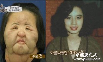 韓國(guó)風(fēng)扇女去世韓國(guó)風(fēng)扇女簡(jiǎn)歷風(fēng)扇女為什么會(huì)癡迷整容