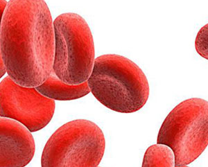 貧血的癥狀大起底 這些預(yù)防貧血的知識(shí)你都知道嗎