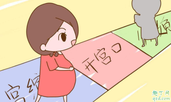 快速開(kāi)宮口吃什么 有沒(méi)有促進(jìn)宮口開(kāi)得快的方法1