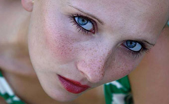 臉上有斑吃香菜會(huì)不會(huì)加重 臉上斑加重了怎么辦