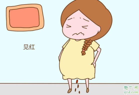 離預(yù)產(chǎn)期近要注意什么 臨近預(yù)產(chǎn)期需要準(zhǔn)備哪些東西2