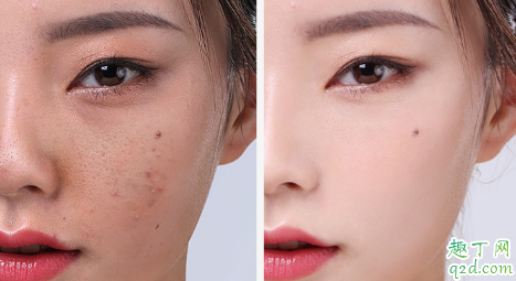 素萃黑醋面膜好用嗎 素萃黑醋面膜使用測(cè)評(píng)2