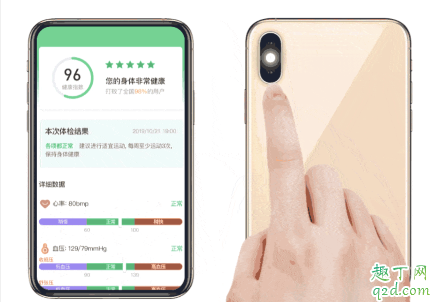 貓撲運(yùn)動(dòng)怎么測血壓 貓撲運(yùn)動(dòng)測血壓準(zhǔn)嗎1