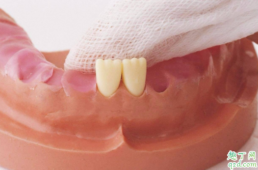 寶寶出牙會有低燒嗎 小孩先長上牙還是下牙3