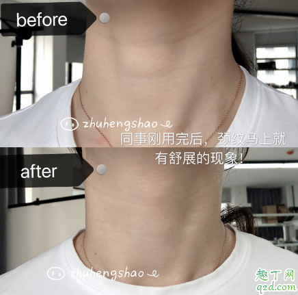 米加頸霜有沒有效果 米加頸霜使用評(píng)測(cè)5